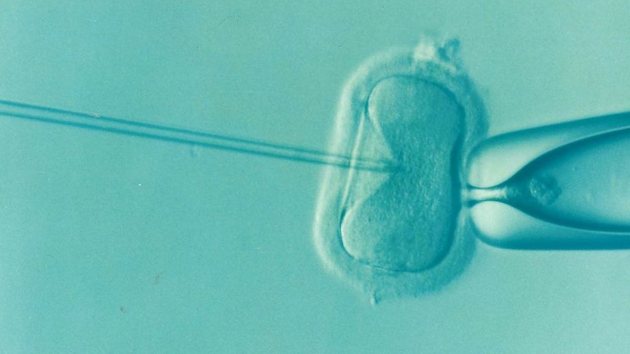 Vantelesna oplodnja – In Vitro Fertilizacija (IVF)